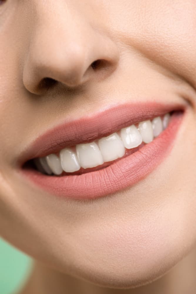 Teeth Whitening | Shore Side Dentistry