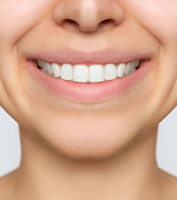 After | Shore Side dentistry Oakville