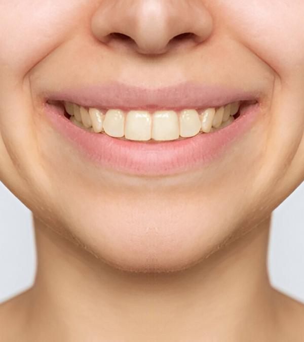 Before | Shore Side dentistry Oakville