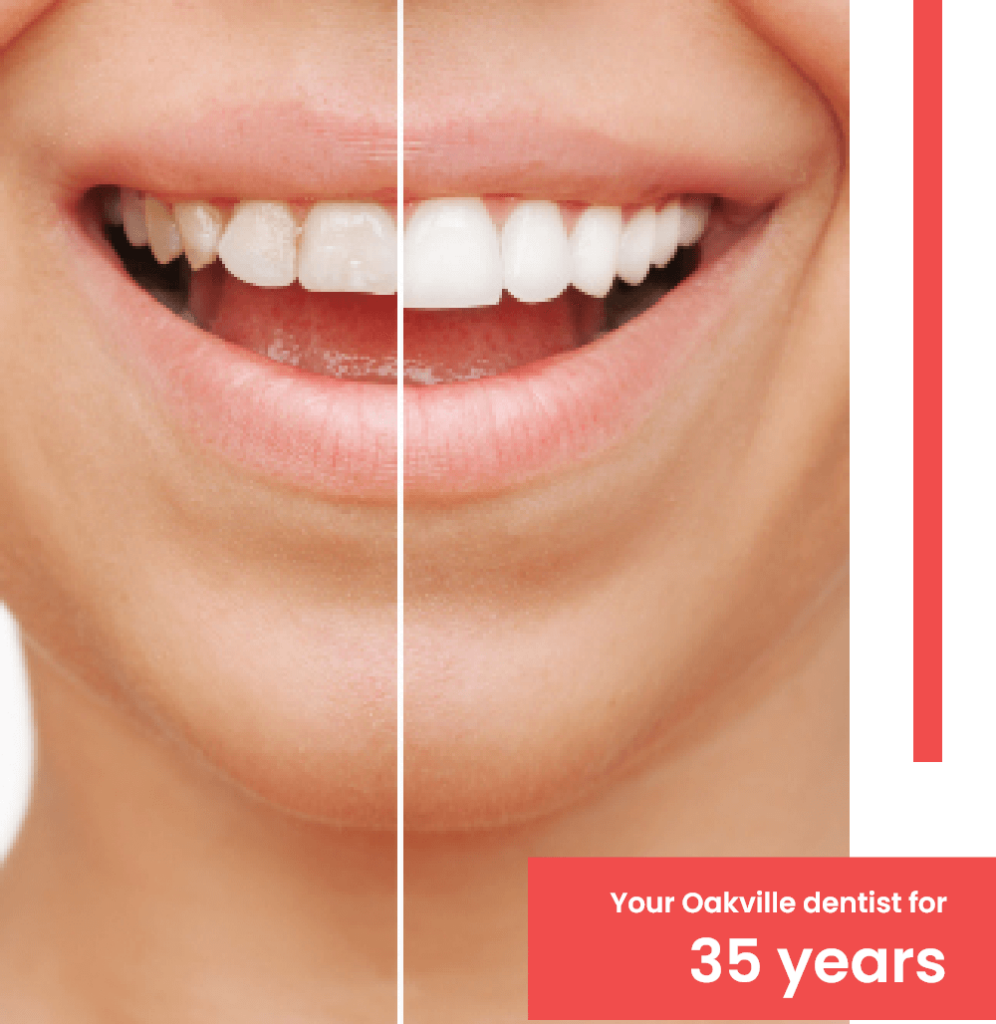 cosmetic dentistry | Shore Side dental Oakville