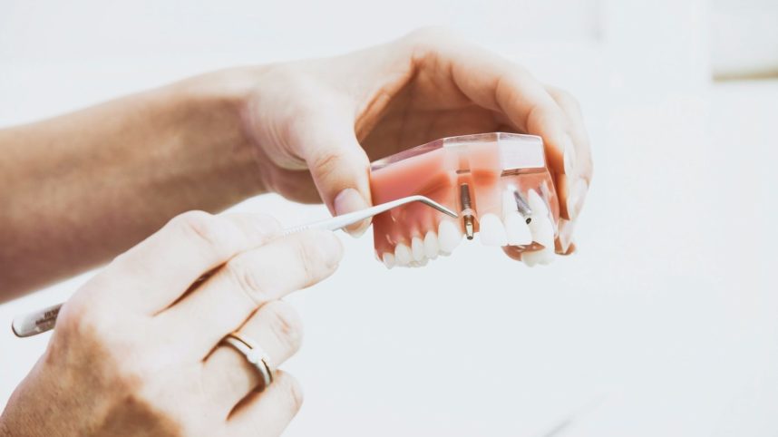 root canal treatment | Shore Side dentistry Oakville