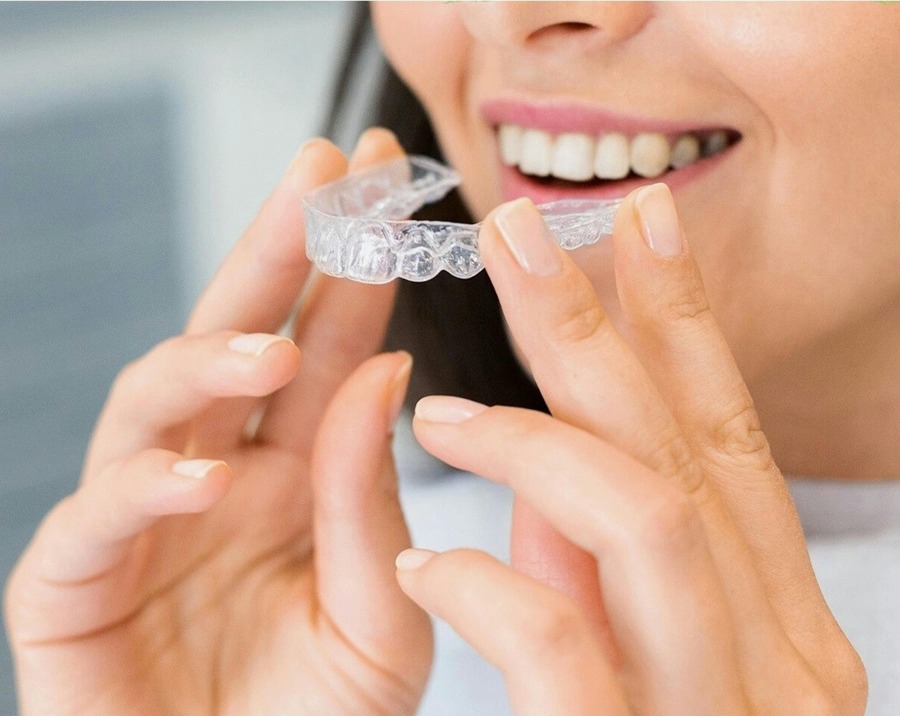 30-Minute Rule: Making Your Invisalign Journey a Success